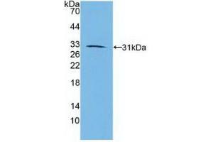 Western blot analysis of recombinant Human RARb. (Retinoic Acid Receptor beta anticorps  (AA 205-451))