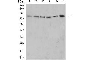 Western blot analysis using PD1 mouse mAb against MOLT4 (1), K562 (2), Ramos (3), HL-60 (4), THP-1 (5), and U937 (6) cell lysate. (PD-1 anticorps  (AA 21-170))