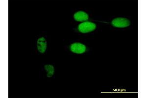 Immunofluorescence of purified MaxPab antibody to TIMELESS on HeLa cell. (TIMELESS anticorps  (AA 1-1208))