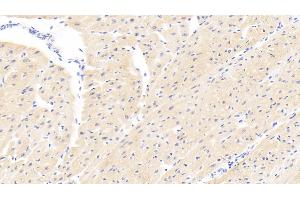 Detection of PARP4 in Human Cardiac Muscle Tissue using Polyclonal Antibody to Poly ADP Ribose Polymerase 4 (PARP4)