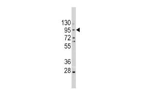 Western blot analysis of CDH1 Antibody in A375 cell line lysates (35ug/lane)