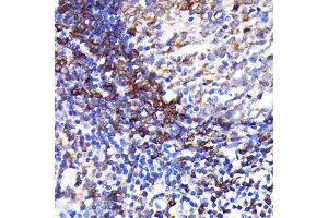Immunohistochemistry of paraffin-embedded human appendix using SHP1 Rabbit mAb (ABIN7269716) at dilution of 1:100 (40x lens). (SHP1 anticorps)
