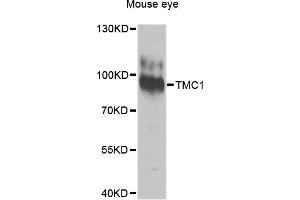 Western blot analysis of extracts of mouse eye, using TMC1 antibody. (TMC1 anticorps)