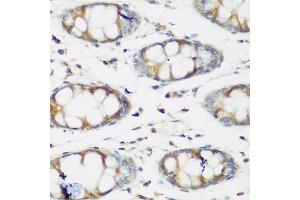 Immunohistochemistry of paraffin-embedded human colon using BMP2 antibody. (BMP2 anticorps  (AA 283-396))