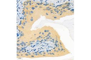 Immunohistochemistry of paraffin embedded mouse bladder using Tnfaip2 (ABIN7076074) at dilution of 1:600 (400x lens) (TNFAIP2 anticorps)