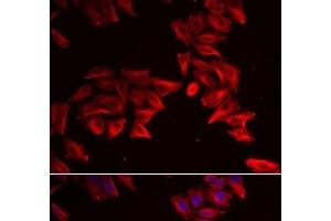 Immunofluorescence analysis of HeLa cells using SFRP4 Polyclonal Antibody (SFRP4 anticorps)