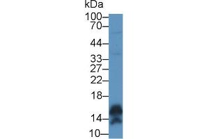 Western blot analysis of Human A431 cell lysate, using Human CALML5 Antibody (1 µg/ml) and HRP-conjugated Goat Anti-Rabbit antibody (