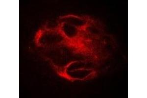 Immunofluorescent analysis of RBAT staining in Hela cells. (SLC3A1 anticorps)
