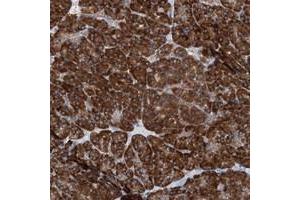 Immunohistochemical staining of human pancreas with UFL1 polyclonal antibody  shows strong cytoplasmic positivity in exocrine glandular cells at 1:20-1:50 dilution. (UFL1 anticorps)