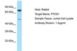 Image no. 1 for anti-Pentatricopeptide Repeat Domain 1 (PTCD1) (AA 51-100) antibody (ABIN6750226) (PTCD1 anticorps  (AA 51-100))