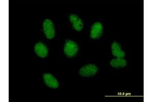 Immunofluorescence of purified MaxPab antibody to NSMCE1 on HeLa cell. (NSMCE1 anticorps  (AA 1-256))