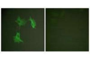 Immunofluorescence analysis of NIH/3T3 cells, using Tubulin α antibody. (TUBA1A anticorps  (C-Term))
