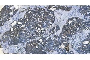 IHC analysis of GABARAP using anti-GABARAP antibody (ABIN7603159). (GABARAP anticorps  (N-Term))
