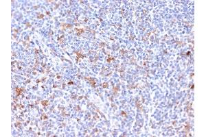 Formalin-fixed, paraffin-embedded human Tonsil stained with RCAS1 Mouse Monoclonal Antibody (CPTC-EBAG9-2).