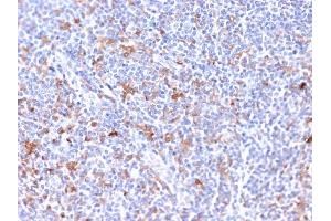 Formalin-fixed, paraffin-embedded human Tonsil stained with RCAS1 Mouse Monoclonal Antibody (CPTC-EBAG9-2). (RCAS1 anticorps)