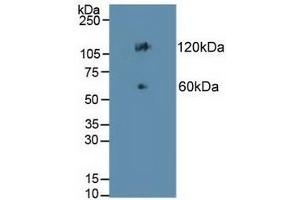 Detection of CDH17 in Mouse Colon Tissue using Polyclonal Antibody to Cadherin 17 (CDH17) (LI Cadherin anticorps  (AA 67-351))