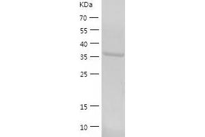 Western Blotting (WB) image for RNA terminal Phosphate Cyclase Domain 1 (RTCD1) (AA 1-366) protein (His-IF2DI Tag) (ABIN7124931)