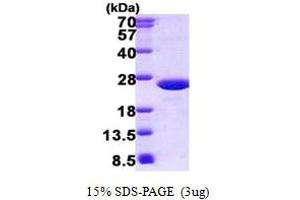 SDS-PAGE (SDS) image for Solute Carrier Family 25 (Mitochondrial Thiamine Pyrophosphate Carrier), Member 19 (SLC25A19) (AA 19-180) protein (His tag) (ABIN5852936)