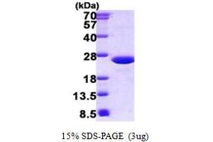 SDS-PAGE (SDS) image for Solute Carrier Family 25 (Mitochondrial Thiamine Pyrophosphate Carrier), Member 19 (SLC25A19) (AA 19-180) protein (His tag) (ABIN5852936) (SLC25A19 Protein (AA 19-180) (His tag))