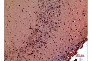 Immunohistochemistry (IHC) analysis of paraffin-embedded Mouse Brain, antibody was diluted at 1:100.
