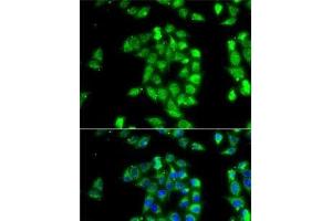 Immunofluorescence analysis of MCF7 cells using ANTXR1 Polyclonal Antibody (ANTXR1 anticorps)