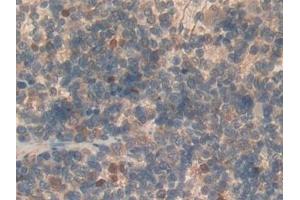 Detection of SEMA3A in Rat Spleen Tissue using Polyclonal Antibody to Semaphorin 3A (SEMA3A)