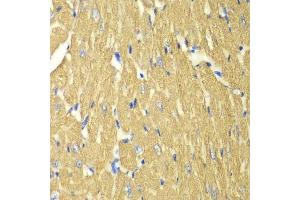 Immunohistochemistry of paraffin-embedded mouse heart using TPM3 antibody. (TPM3 anticorps  (AA 1-284))