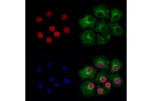 ABIN6264887 and ABIN6276947 staining Hela cells by IF/ICC. (RUVBL2 anticorps  (Internal Region))