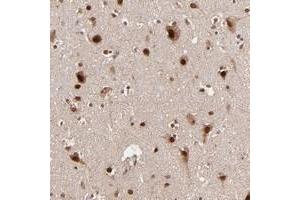 Immunohistochemical staining of human cerebral cortex with TOP1MT polyclonal antibody  shows strong nuclear and cytoplasmic positivity in neuronal cells. (TOP1MT anticorps)