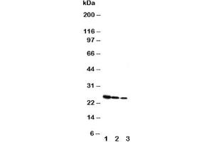Western blot testing of Growth Hormone antibody and Lane 1:  Recombinant rat GH protein 10ng;  2: 5ng;  3: 2. (Growth Hormone 1 anticorps  (AA 27-216))