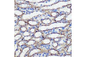 Immunohistochemistry of paraffin-embedded Mouse kidney using SND1 Rabbit pAb (ABIN6129741, ABIN6148197, ABIN6148199 and ABIN6221577) at dilution of 1:100 (40x lens).
