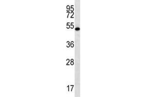 RNF8 antibody western blot analysis in mouse spleen tissue lysate. (RNF8 anticorps  (AA 335-364))