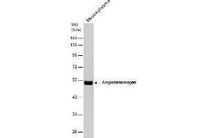 WB Image Mouse tissue extract (50 μg) was separated by 10% SDS-PAGE, and the membrane was blotted with Angiotensinogen antibody [N1C3] , diluted at 1:1000. (AGT anticorps)