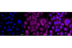 Immunocytochemical staining of HT- cells with Retinoic acid receptor alpha antibody (ABIN7800189), 1:1,000). (Recombinant Retinoic Acid Receptor alpha anticorps)