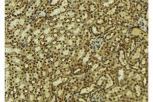 ABIN6277519 at 1/100 staining Mouse kidney tissue by IHC-P. (PRKACB anticorps  (C-Term))