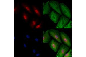 ABIN6257451 and ABIN6273495 staining  cells by IF/ICC. (RAD1 anticorps  (Internal Region))