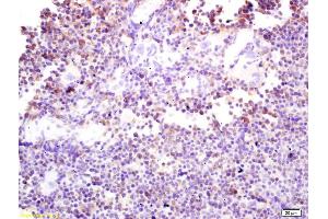 Formalin-fixed and paraffin embedded mouse spleen labeled with Rabbit Anti phospho-DAB2 (Ser24) Polyclonal Antibody, Unconjugated (ABIN1386225) at 1:200 followed by conjugation to the secondary antibody and DAB staining
