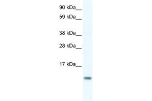 FXYD5 antibody used at 0. (FXYD5 anticorps  (N-Term))