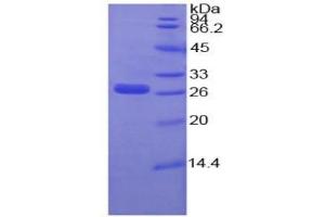 SDS-PAGE of Protein Standard from the Kit  (Highly purified E. (IGFBP4 Kit ELISA)