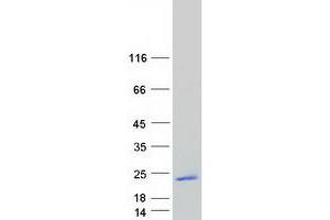 Validation with Western Blot