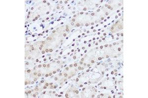 Immunohistochemistry of paraffin-embedded mouse kidney using S Rabbit pAb (ABIN6132631, ABIN6147390, ABIN6147391 and ABIN6224669) at dilution of 1:100 (40x lens). (SART1 anticorps  (AA 1-255))