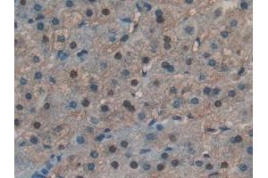 Figure. (RNASE4 anticorps  (AA 30-147))