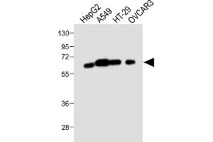 All lanes : Anti-CYP3A4 Antibody (Center) at 1:1000 dilution Lane 1: HepG2 whole cell lysate Lane 2: A549 whole cell lysate Lane 3: HT-29 whole cell lysate Lane 4: OVCAR3 whole cell lysate Lysates/proteins at 20 μg per lane.