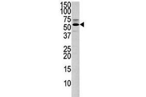 Western blot analysis of PTEN antibody and 293 lysate.