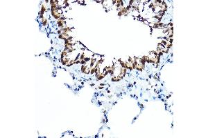 Immunohistochemistry of paraffin-embedded rat lung using FOX Rabbit pAb (5278) at dilution of 1:100 (40x lens). (FOXA1 anticorps  (AA 263-472))