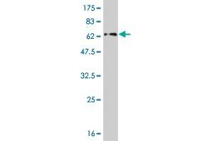 Western Blot detection against Immunogen (59. (ZNF215 anticorps  (AA 1-304))