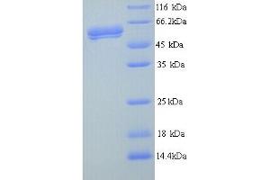 SDS-PAGE (SDS) image for Fused in Sarcoma (FUS) (AA 27-529) protein (His tag) (ABIN5714158)