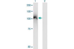 Western Blot analysis of CBL expression in transfected 293T cell line by CBL monoclonal antibody (M01), clone 6D12. (CBL anticorps  (AA 736-835))