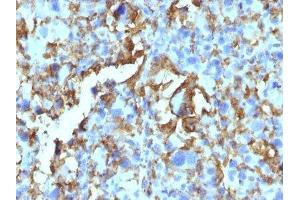 Image no. 3 for anti-Major Histocompatibility Complex, Class II, DR beta 1 (HLA-DRB1) antibody (ABIN6186381) (HLA-DRB1 anticorps)