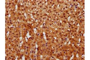 IHC image of ABIN7153551 diluted at 1:400 and staining in paraffin-embedded human adrenal gland tissue performed on a Leica BondTM system. (GGCT anticorps  (AA 54-188))